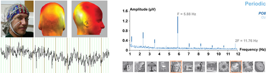 Enregistrement non-invasif de l’activité neurale à l’aide de l’EEG à haute densité (Biosemi)