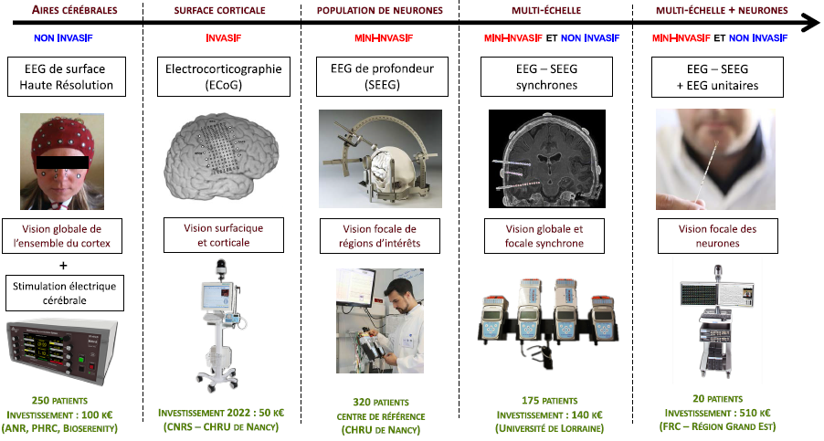 Enregistrement EEG multi-échelle par macro et micro-électrodes