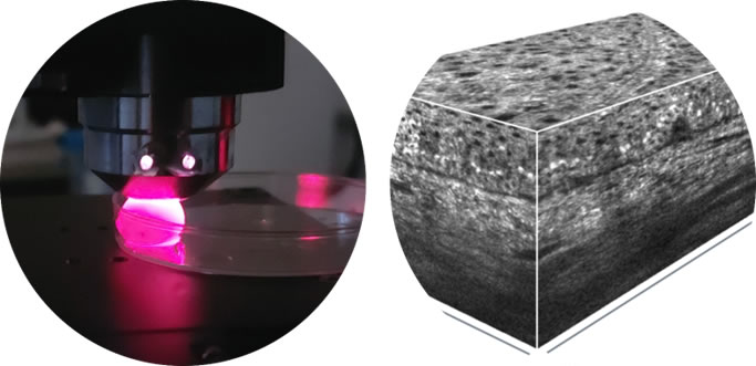 PhotoVivo : « Plateforme de développement de méthodes optiques innovantes pour la caractérisation des tissus biologiques par méthodes optiques multispectrales label free appliquées au diagnostic du cancer »