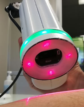 PhotoVivo : « Plateforme de développement de méthodes optiques innovantes pour la caractérisation des tissus biologiques par méthodes optiques multispectrales label free appliquées au diagnostic du cancer »